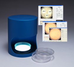 Low Cost IncuCount Colony Counter